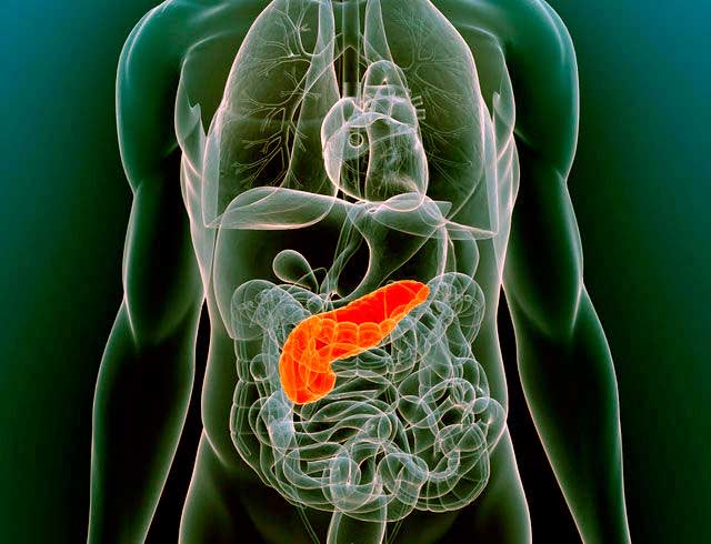 cirugia-del-pancreas-iocir