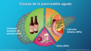 causas-pancreatitis