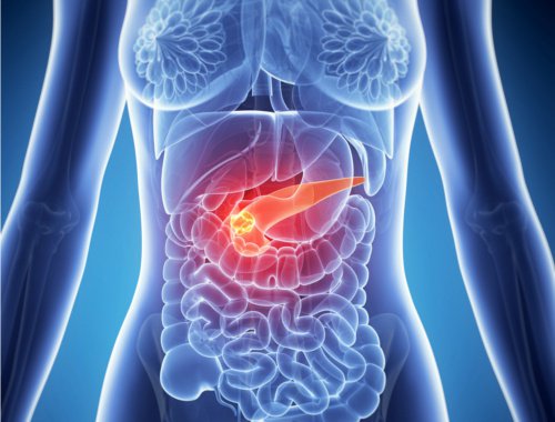 pancreatitis-iocir