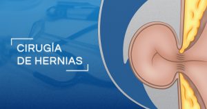 cirugia-hernias-banner