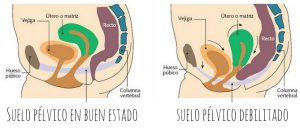 suelo pélvico gráfico