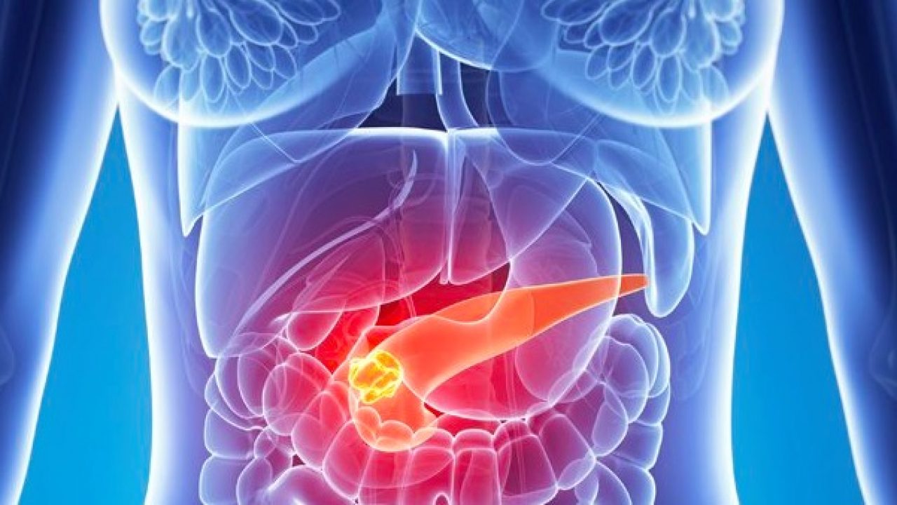 cancer de pancreas tratamiento Merca2.es