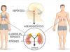 Síndrome de Cushing: Síntomas, causas y tratamiento